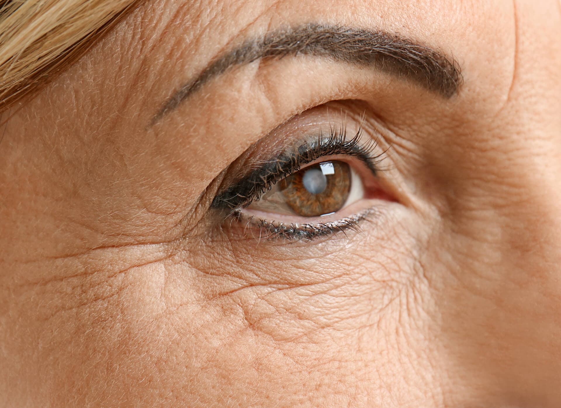 Diagnosis de glaucomas
