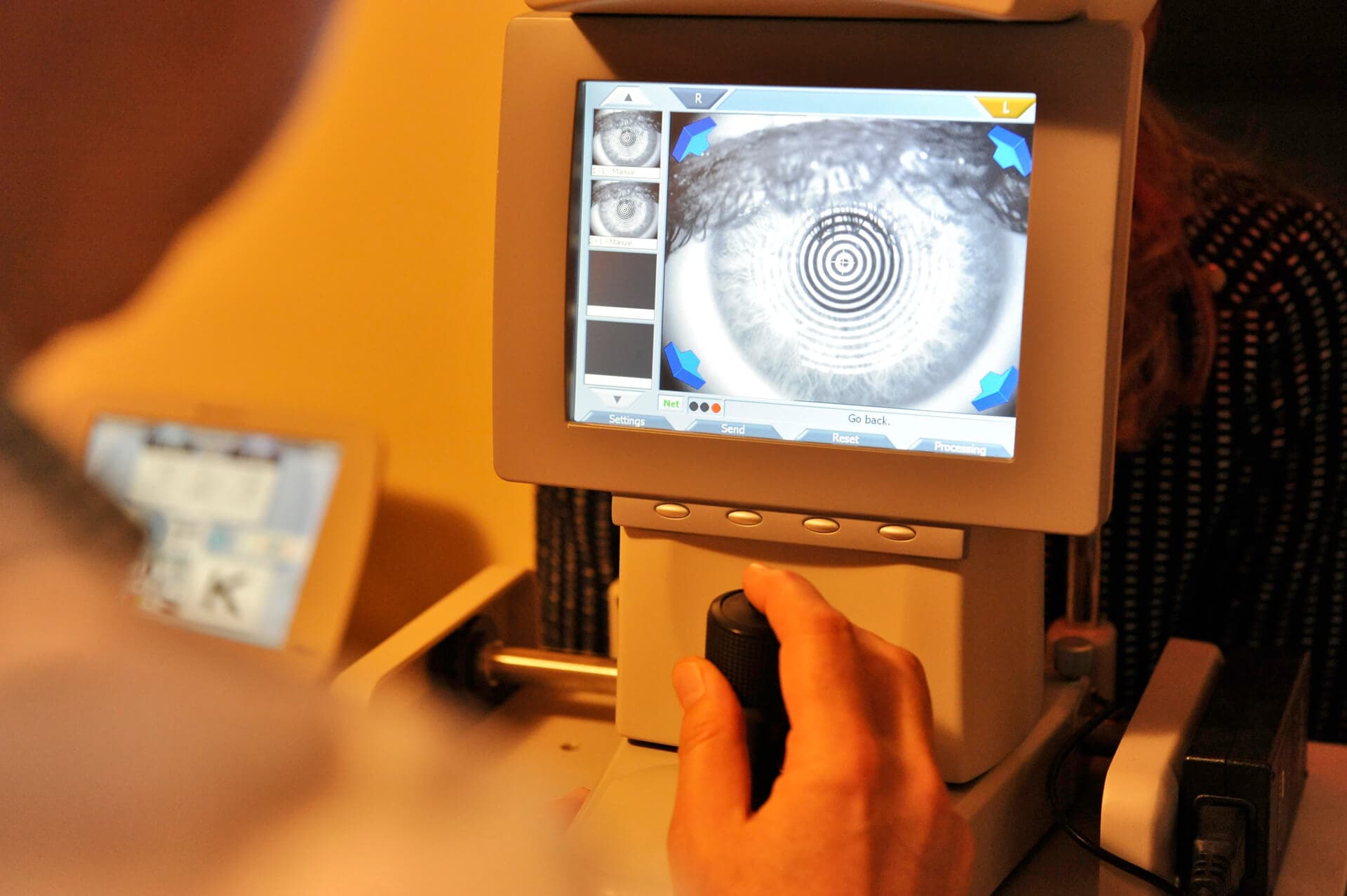 Cirugía ocular por oculistas expertos en Santiago