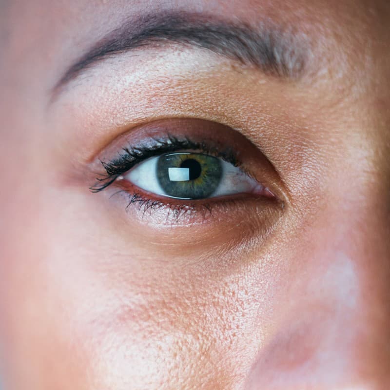 Lentes pseudofáquicas