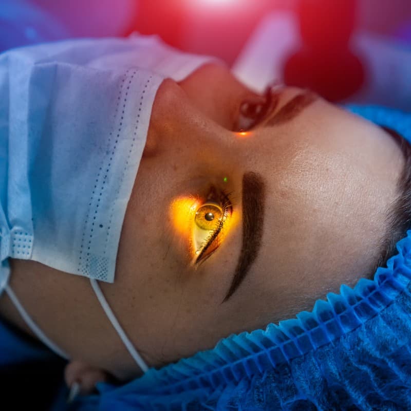 Técnica Lasik