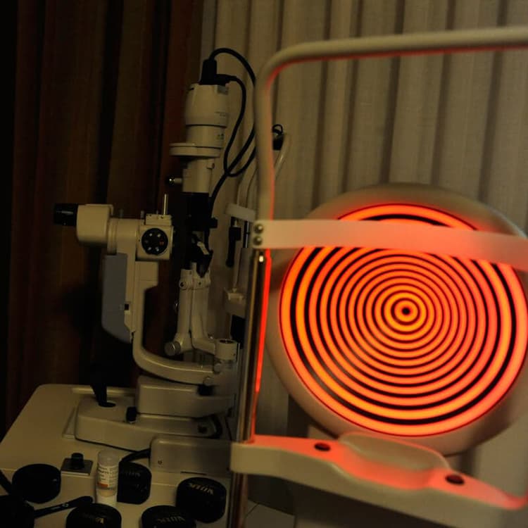 Topógrafo Corneal